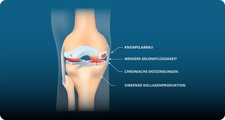Kniegelenk Anatomie – Knorpelabbau, Gelenkflüssigkeit, Entzündungen, Kollagenproduktion