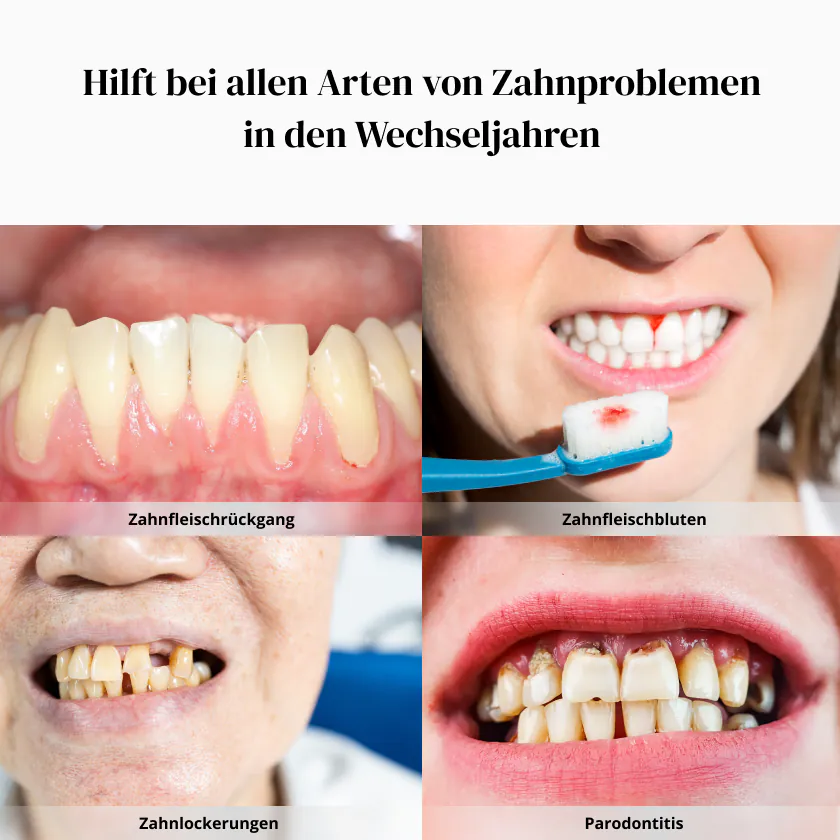 wellbe Kollagen Zahnfleischprobleme